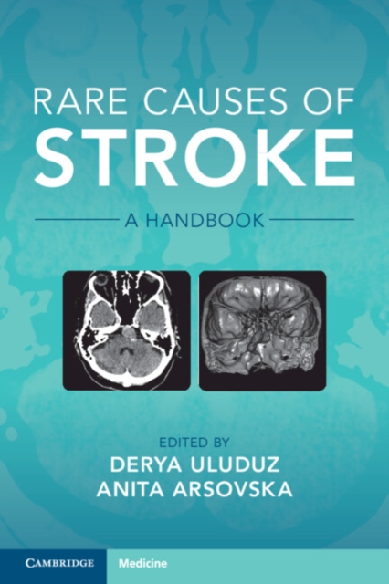 Rare Causes of Stroke : A Handbook