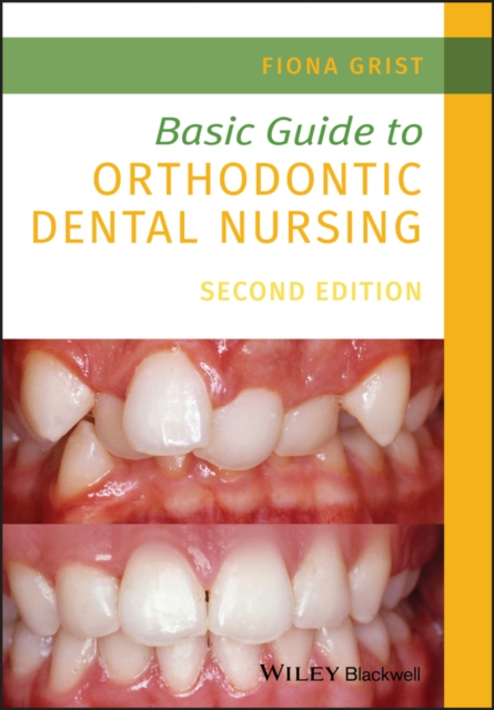 Basic Guide to Orthodontic Dental Nursing (New Edition)