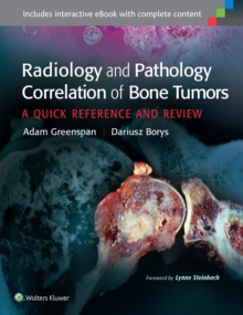 Radiology and Pathology Correlation of Bone Tumors : A Quick Reference and Review
