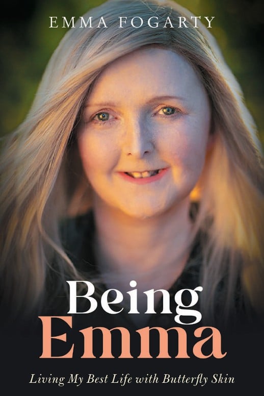 Being Emma : Living My Best Life with Butterfly Skin (Memoir)