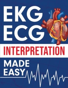 EKG ECG Interpretation Made Easy