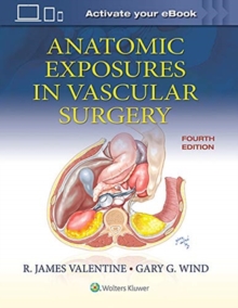 Anatomic Exposures in Vascular Surgery (4th Edition)(Hardback)