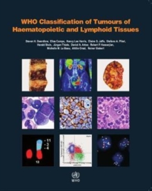 WHO Classification of Tumours of Haematopoietic and Lymphoid Tissues : Vol. 2 : 2 (4th edition Revised)